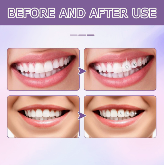 Tooth Gem Glue 7ml Dental Adhesive for Tooth Gems Diamond Kit Glue Teeth Crystal Jewelry Sturdy Tooth Jewelry Orthodontic Gel