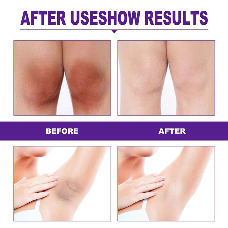 Female Tightening Gel Vaginal Shrink Cream Tighter For Women Sexy Aid Be Always Again Cream Make Him Feel Bigger Orgasm Gel 20g
