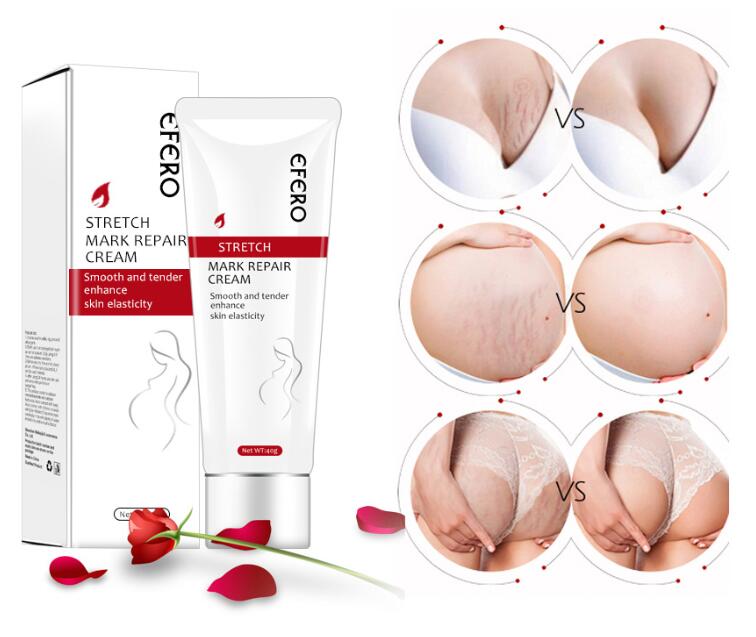 EFERO Postpartum Stretch Mark Cream Removal Scar and Stretch Mark Removal Cream Stretch Mark Cream