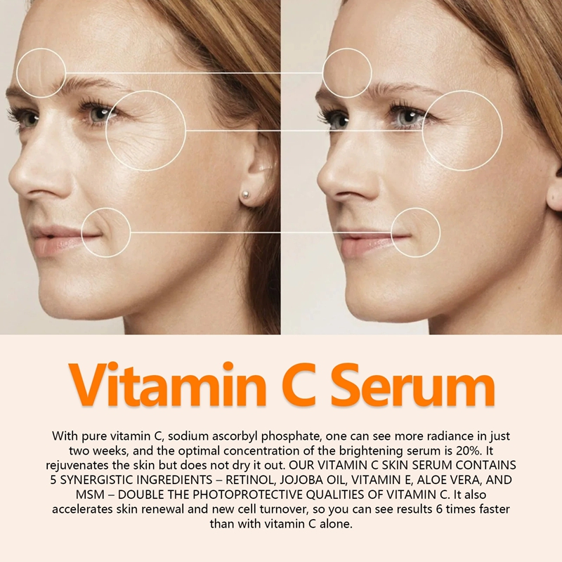 Vitamin C Whitening Serum Face Freckle Fade Dark Spot Pigment Melanin Corrector and Powerful Whitening Serum for Face