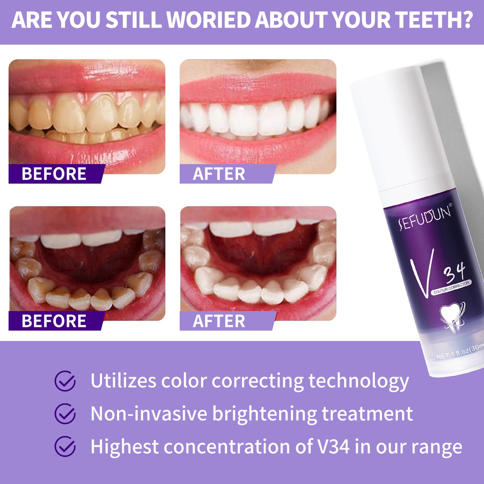Whitening Toothpaste Non-Invasive Removing Tooth Stains Whitening Teeth Remove Dental Stains Repair Teeth Damage Calcification
