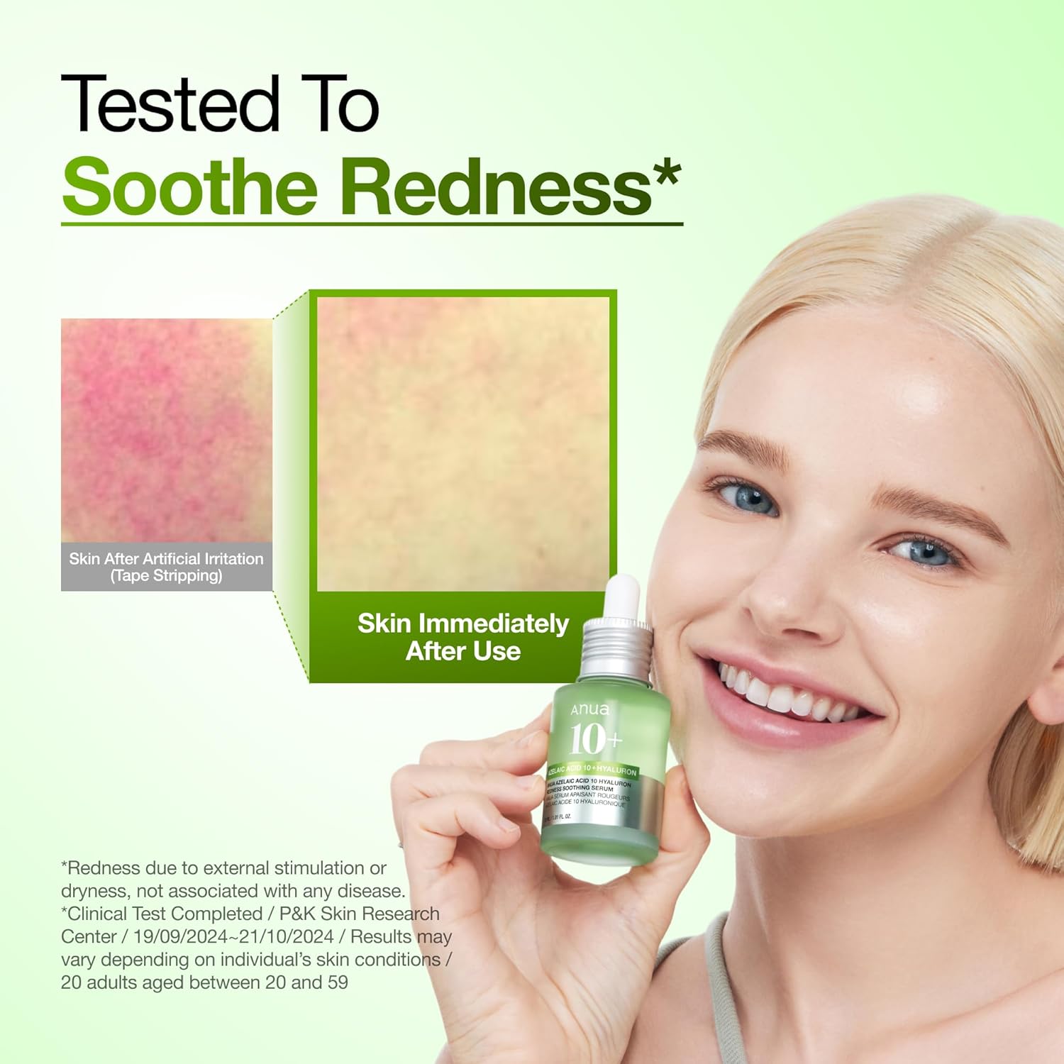 Anua Azelaic Acid 10 Hyaluron Redness Soothing Serum, Facial Serum for Blemish-Prone & Oily-Prone Skin, Lightweight & Hydrating Blemish Care, Hyaluron