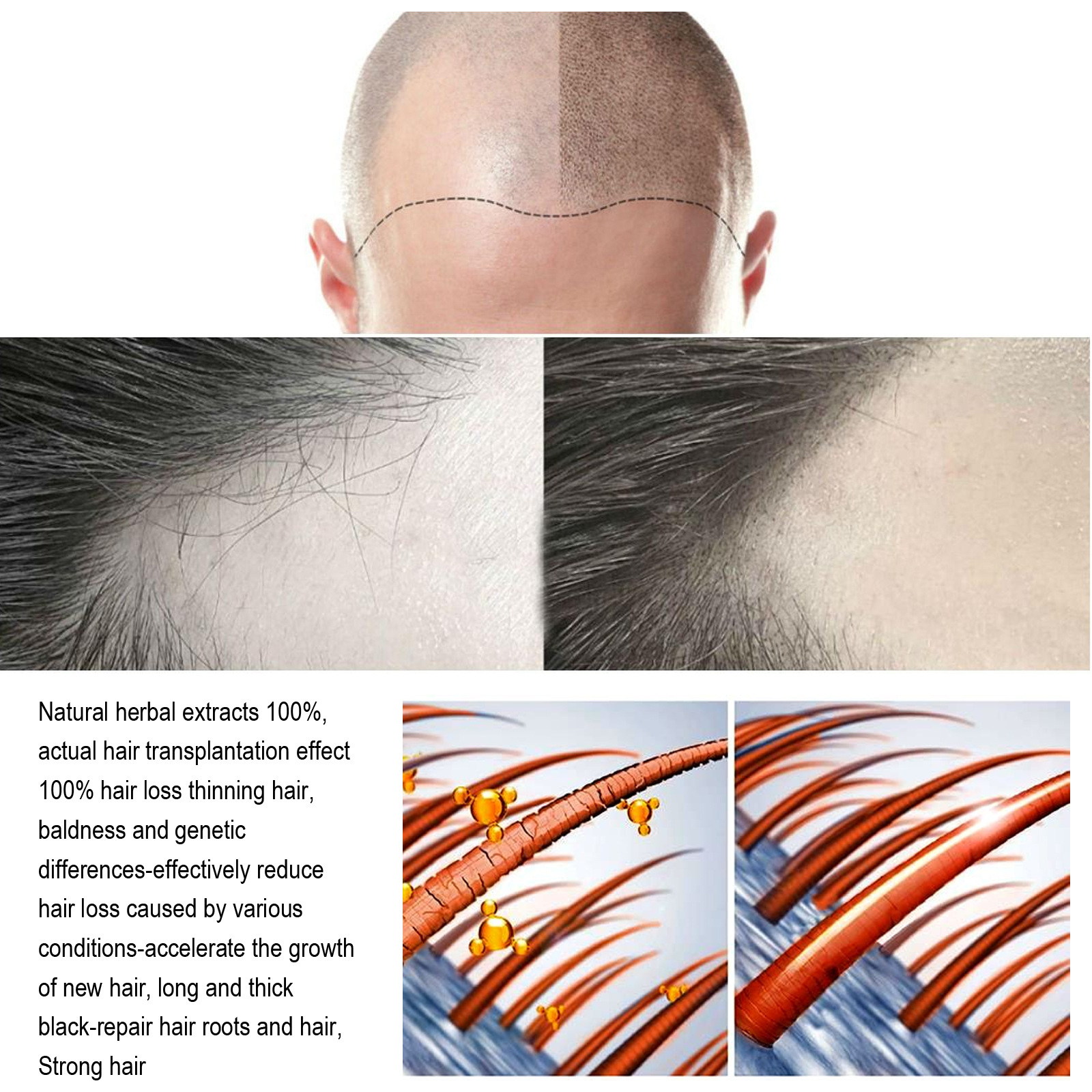 20ML Anti Hair Loss Serum Fast Growing Strengthens Hair Anti-Break Root Damage Hair Care Smooth Bright Hair Ginger Conditioning