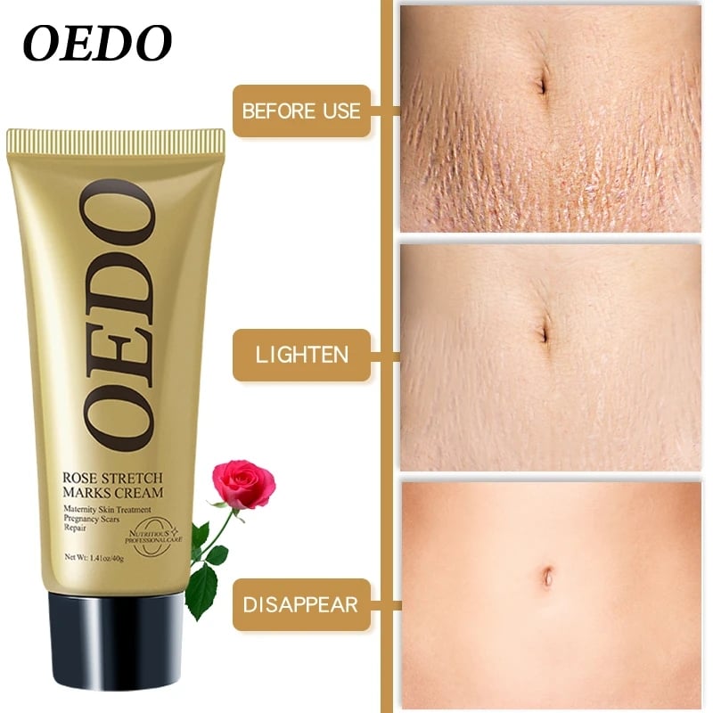 Rose Remove Stretch Marks Cream Anti Wrinkle Anti Aging Maternity Skin Repair Remove Pregnancy Scars Treatment Body Skin