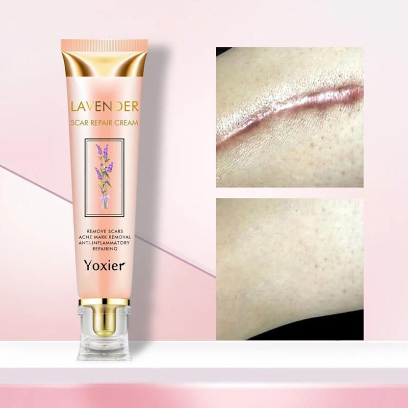 Yoxier Lavender Scar Repair Cream Acne Scars Pigmentation Corrector Remove Stretch Marks Smooth Skin Whitening Scar Care