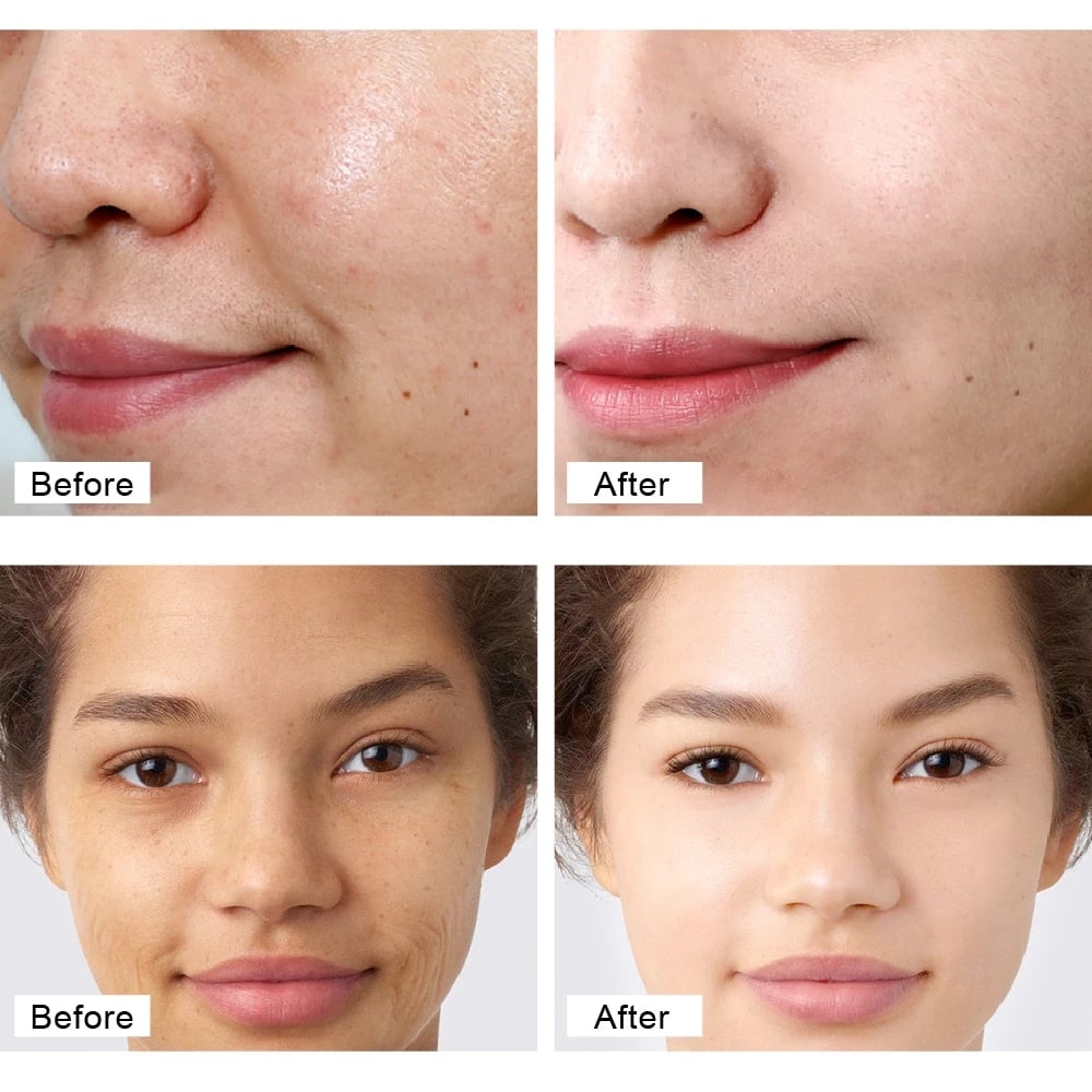 Retinol Face Cream Anti-Aging Remove Wrinkle Firming Lifting Whitening Brightening Moisturizing Facial Skin Care