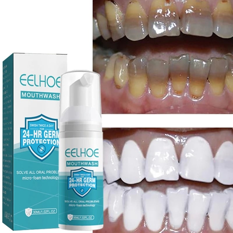 Deep Cleansing Teeth Mousse Toothpaste Press-on Cleaning and Whitening Teeth Smoke Stains Tartar Anti-tooth Decay Fresh Breath