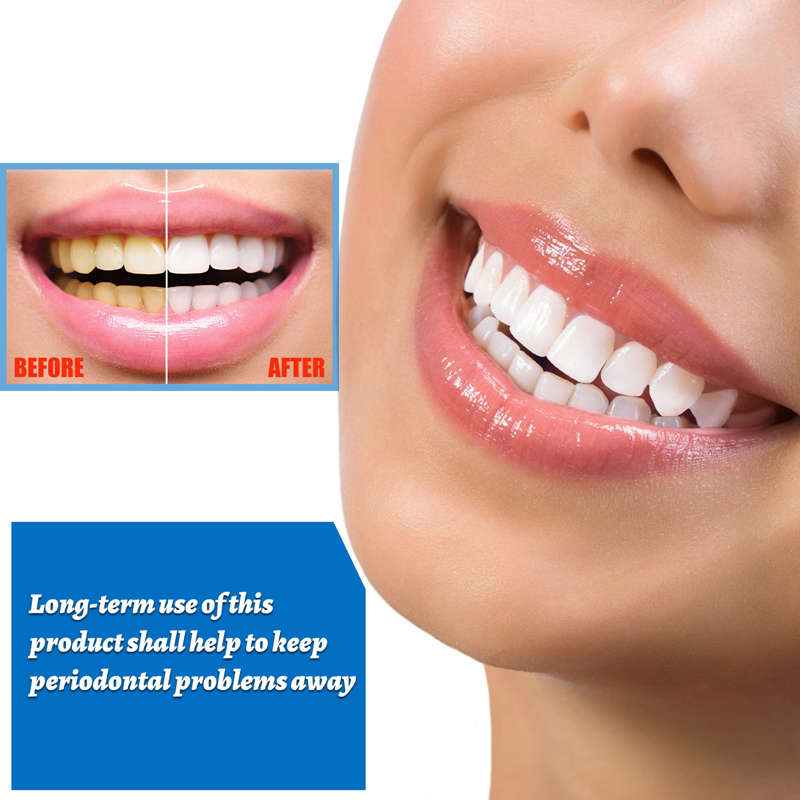 Teeth Whitening Essence Remove Plaque Stains Serum Fresh Breath Oral Hygiene Against Dental Caries Dental Teeth Bleaching Tools