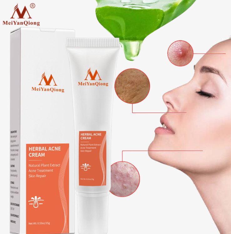 Face Acne Cleaning Cream Skin Care Remove Repair Comedone Pimple Acne Quickly Face Acne Cream Remover Anti Acne Treatment