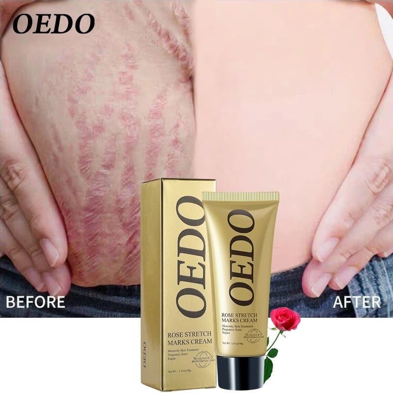 Rose Remove Stretch Marks Cream Anti Wrinkle Anti Aging Maternity Skin Repair Remove Pregnancy Scars Treatment Body Skin