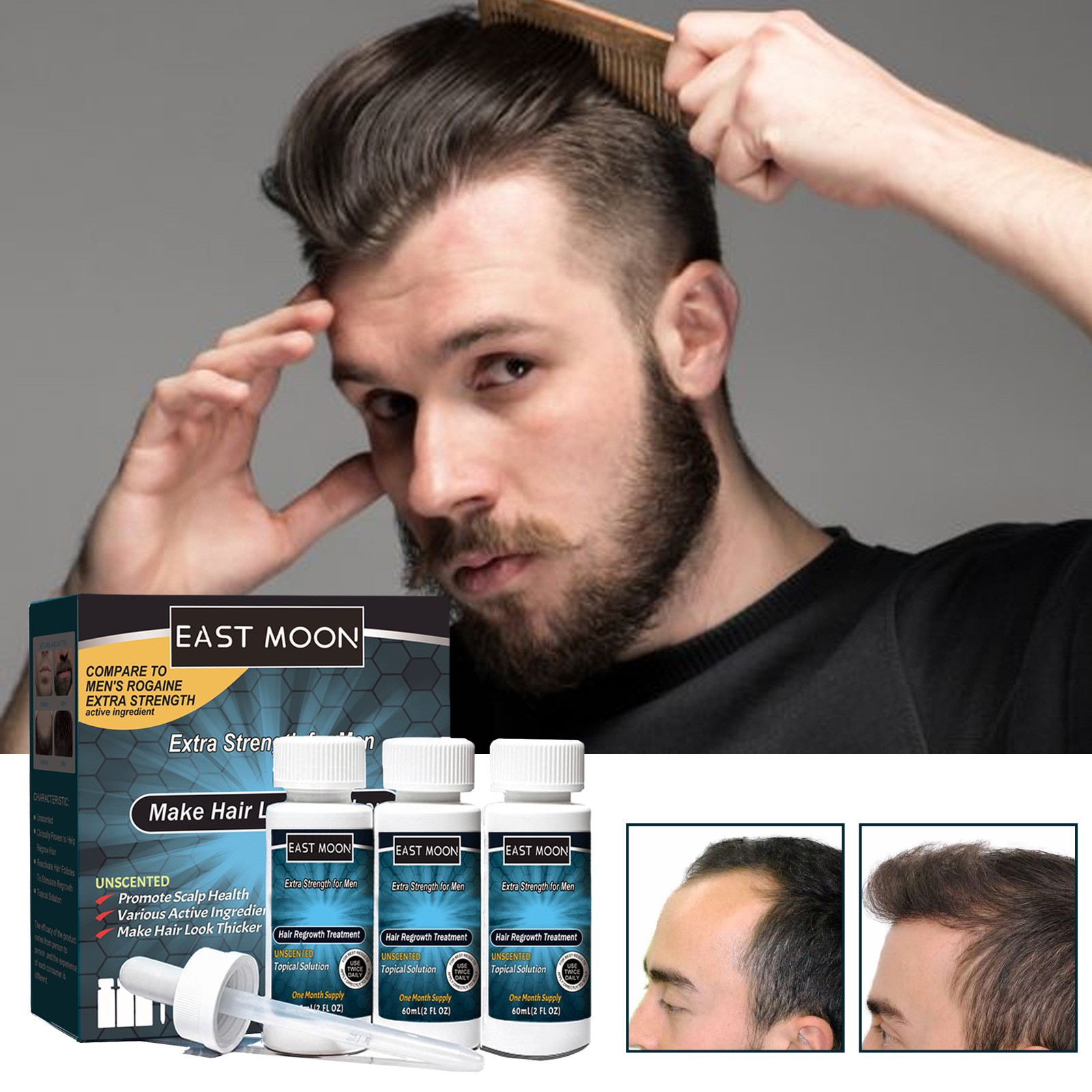 EAST MOON Men's Dense Hair Lotion Men's Anti dropping Firm Hair Dense Moisturizing Hair Nutrition Care essence