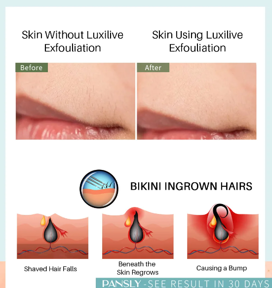 100ML Pansly Dual-Action Ingrown Hair Serum – Exfoliating + Soothing Technology to Prevent Bumps, Calm Redness & Brighten Post-S