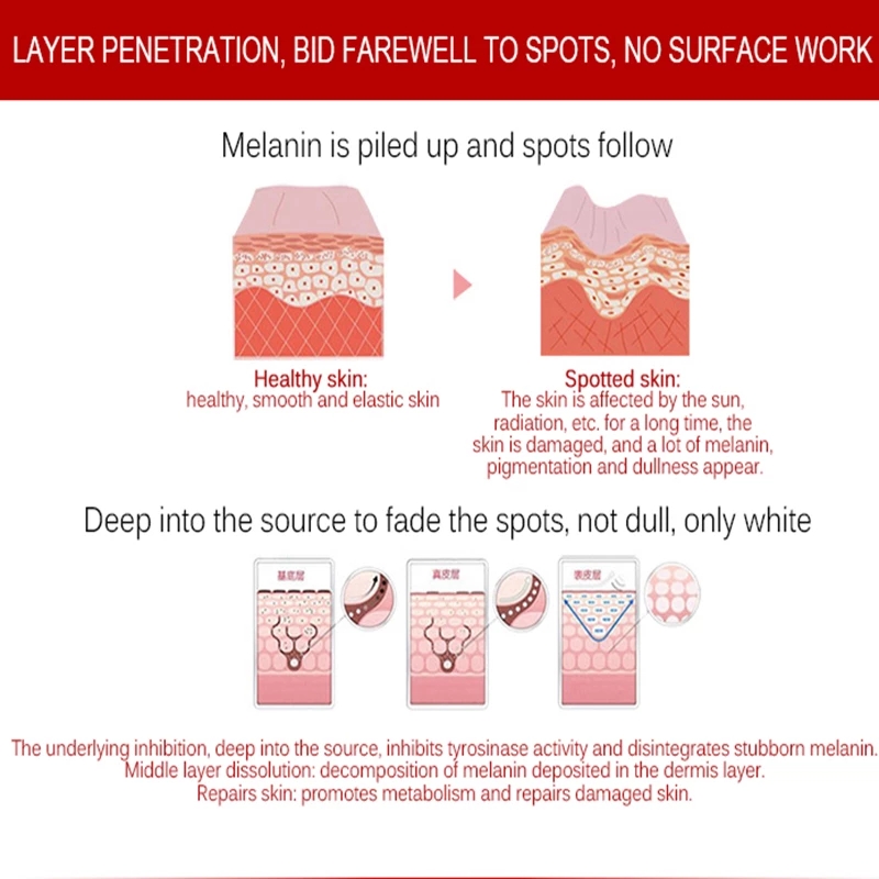 Whitening cream freckles pigmentation melasma removal skin lightening for dark spot manchas remover for face anti aging 2 in 1