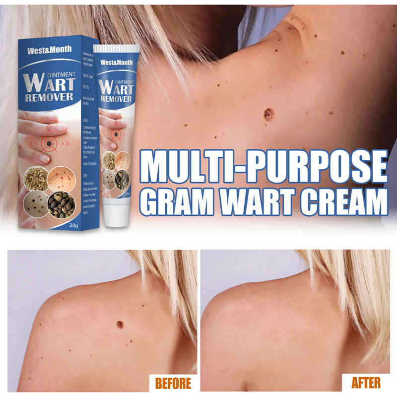Skin Tag Remover Cream Painless Mole Skin Dark Spot Warts Remover Serum Freckle Face Wart Tag Treatment Removal Essential OIL