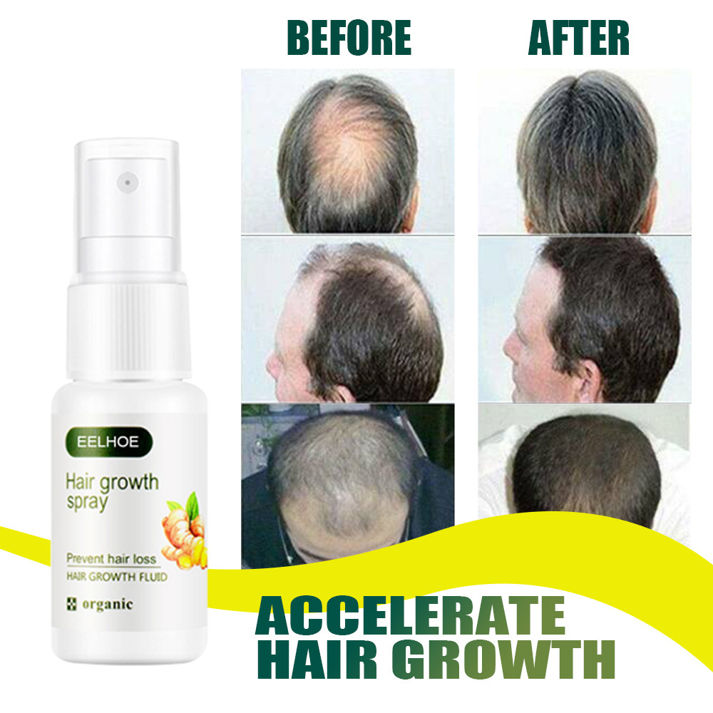 Regrowth Ginger Spray Fast Hair Growth Fluid Anti Loss Treatment Ginger Essence Prevent Hair Loss Regrowth Ginger Spray Eelhoe