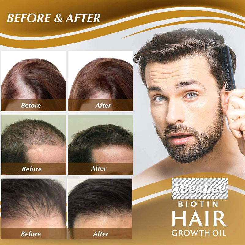 Hair Nourishing Liquid Spray Can Promote the Rapid Growth of Hair, Prevent Baldness, Treat Scalp and Beard, 20ml