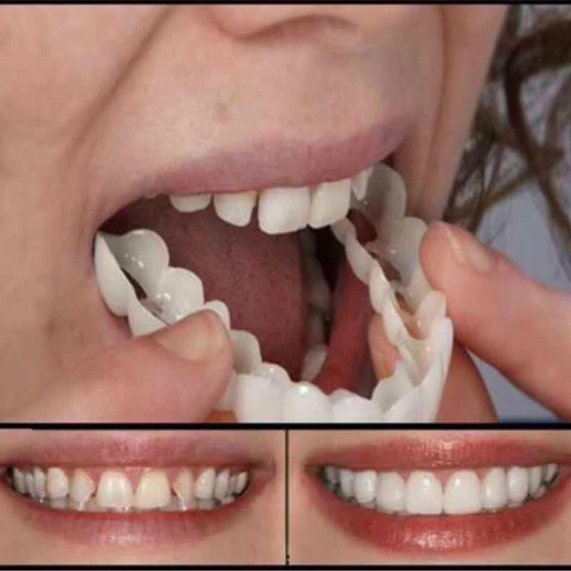 Beautiful Smile Denture Care Creative Teeth Temporary Anti-false Denture