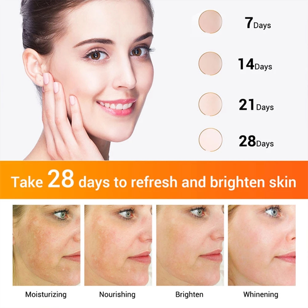 VOVA Effective Whitening Freckle Cream Rich in Vitamin C for Removing Melasma Acne Dark Spots Pigmentation Moisturizing Gel
