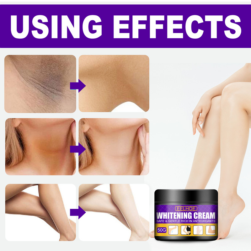 EELHOE skin cream whitens and brightens skin, underarm, knee and elbow moisturizing cream moisturizes skin