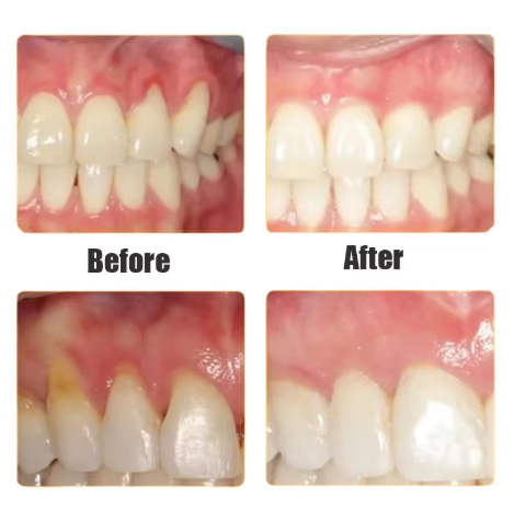 Damaged Gum Repair Care Gel Serum Relieve Sore Gums Allergy Deep Cleaning Teeth Stains Tartar Serum Dental Caries Toothpaste