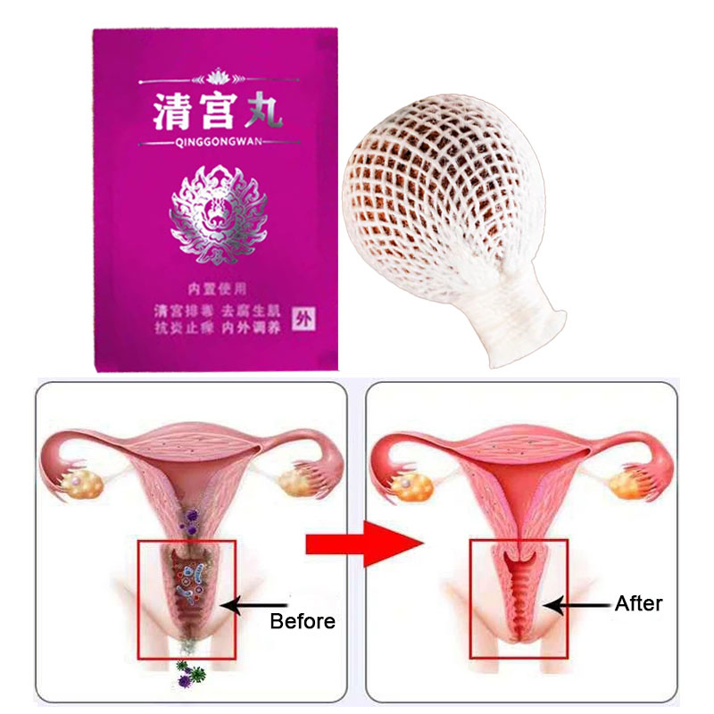10pcs Vaginal Detox Pearls for Women Beautiful Life Point Tampons Chinese medicine Swab tampons discharge toxins gynaecology pad
