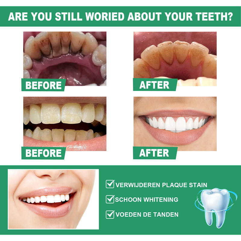 EELHOE Tooth Whitening Powder Cleaning Teeth Oral Care Removing Breath Cleansing Stains Refreshing Breath Tooth Powder