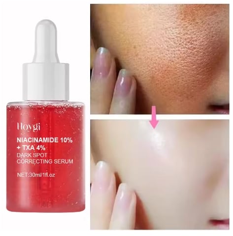 Niacinamide Serum Melanin Removal Fade Melasma Dark Spots Corrector Shrink Pores Hyaluronic Acid Moisturizing Korea Skin Care