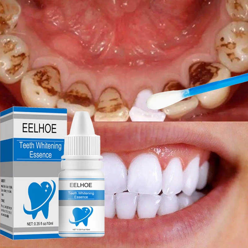 Teeth Whitening Quick Cleaning Tooth whitening solution Remove Plaque Stains Oral Hygiene Tool Show confident smile Tooth care
