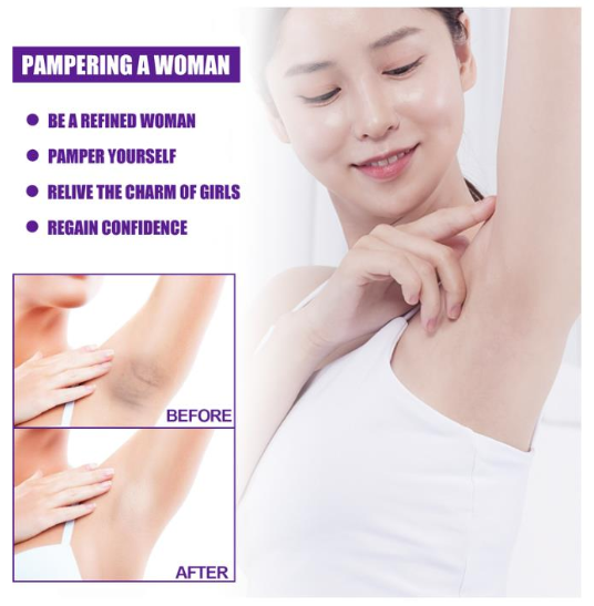 Skin Brightening Cream for Women Private Parts Lightening Cream Underarm Thigh Dark Bleach Serum Remove Melanin Brighten Cream