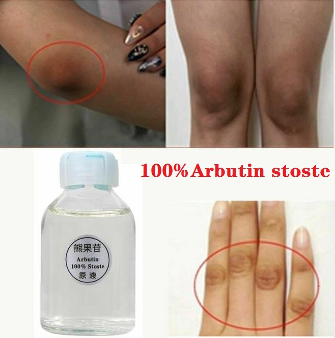 Aroma Diffuser Skin Whitening Lightening Brightening Kojic Acid Serum Bleaching Dark Spot Incense Home Fragrance Aromatherapy