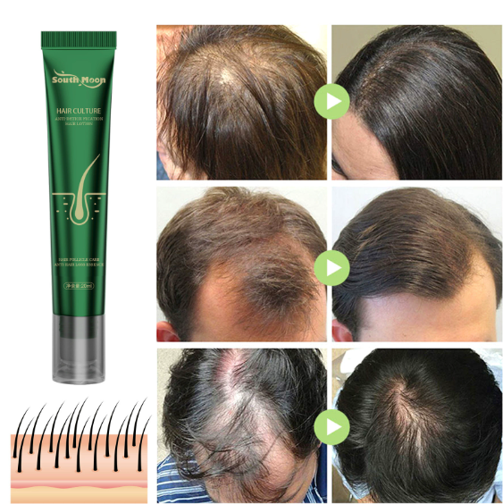 Fast Wild Growth Hair Serum Oil Treatment for Hair Loss Natural Essence for Men Women EXTREME REPAIR For Bald spots