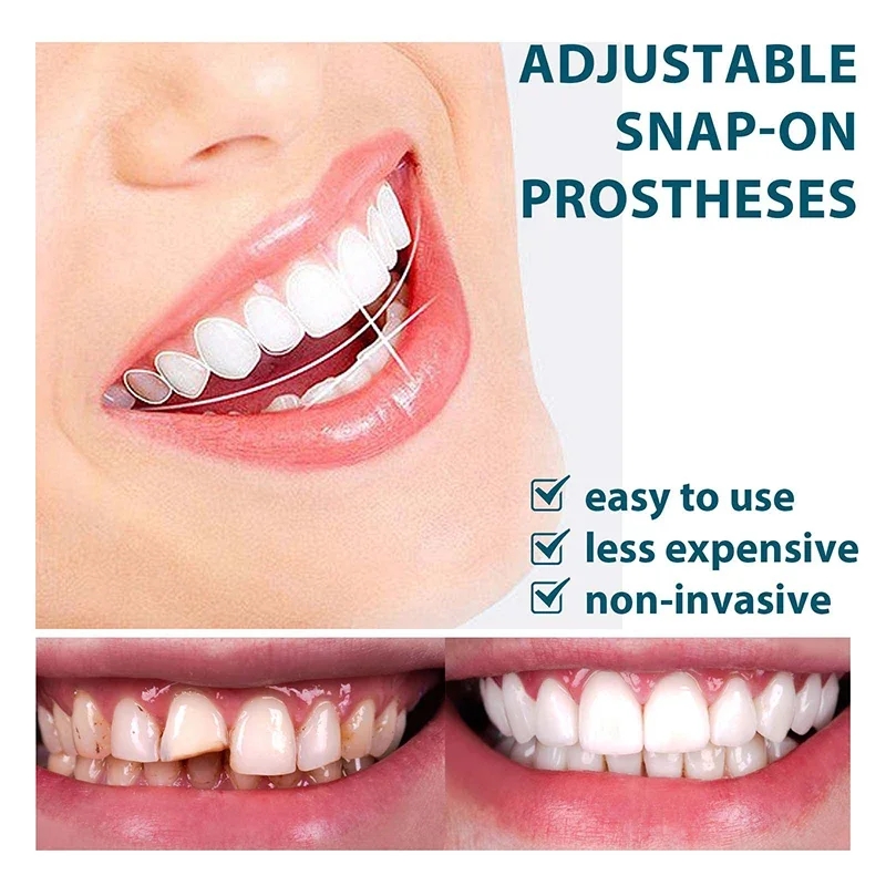 Whitening Tooth Denture Resin Temporary Teeth Braces Teeth Adjustable Denture Teeth Set Instant Smiling Denture Teeth Veneer