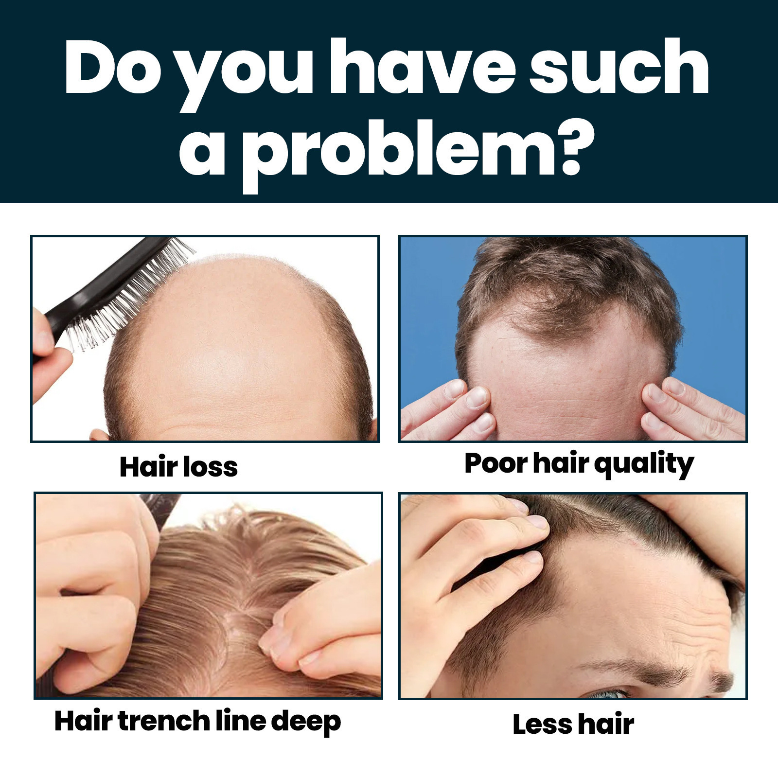 1 Month Supply 5% Extra Strength Men Hair loss man/women