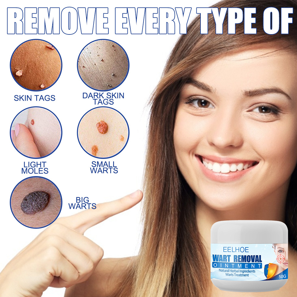 Skin Cleansing To Yukyu Body Care Cream Flat Plantar Wart Clearing Wart Care Cream