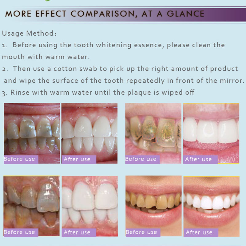 Teeth Whitening Essence Stains Yellow Teeth Treatment Smoke Coffee Plaque Dental Oral Hygiene Remove Whitening Tooth Care