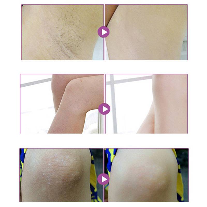 Underarm repair whitening to melanin deodorant antiperspirant to odor apron whitening skin cream