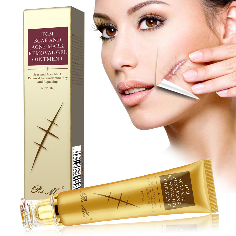 30g Acne Scar Removal Cream Gel Face Pimple Stretch Marks Repairing Cream Smoothing Whitening Moisturizing Skin Care Body Cream