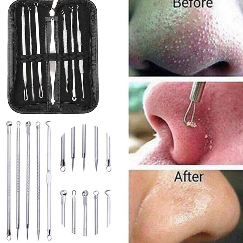 Stainless Steel Extractor Blackhead Remover Needles Acne Pimple Blemish Treatments Face Skin Care Beauty Tools