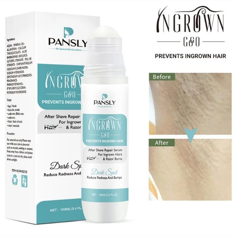 100ml Ingrown Hair Treatment After Shave Repair Dark Spot Serum Hair Growth Removal Inhibitor Painless Bikini Leg Smooth Skin