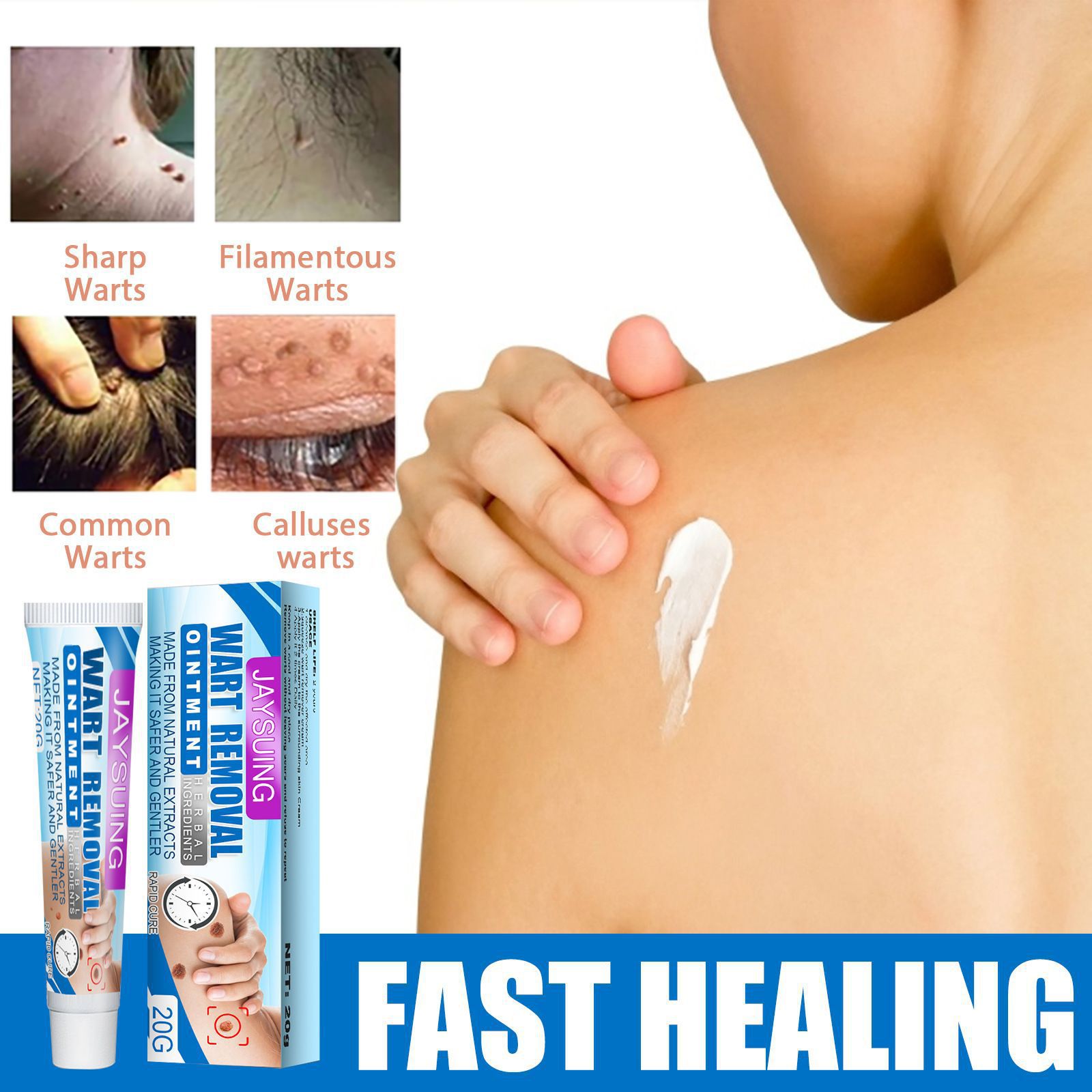 20ml Fast Removal Genital Wart Acne Spot Treatment Skin Tag Remover Against Mole & Genital Wart Fast Rapidly Removes Moles