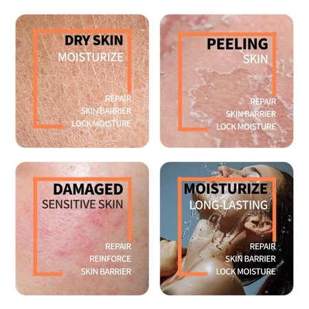 30ml Natural Moisturizing Factors + HA, Lightweight Hydrator for Skin Barrier Support & Hydration Skin Whitening And Melanin