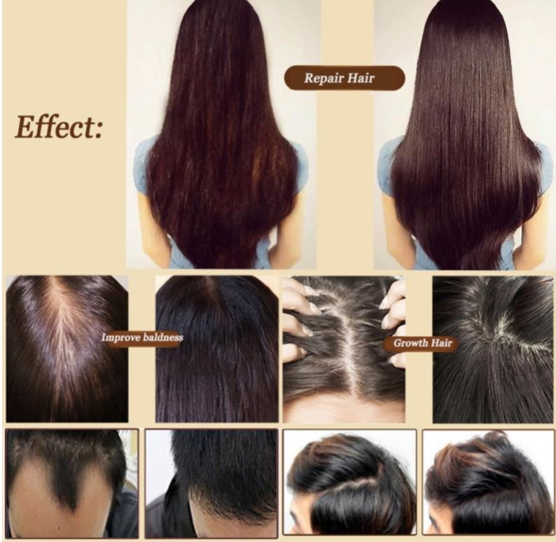 7 Day Fast Hair Growth Essential Oil Effective Hair Loss Treatment Regrowth Ginger Serum Hair Health Care Beauty