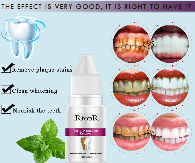 Teeth Whitening Essence Stains Yellow Teeth Treatment Smoke Coffee Plaque Dental Oral Hygiene Remove Whitening Tooth Care