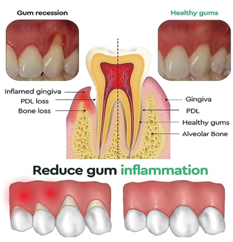 Rapid Repair Gums Gel Effectively Relieve Tooth Allergy Dental Caries Tooth Cleaning Toothpaste Relieve Tooth Damage Serum