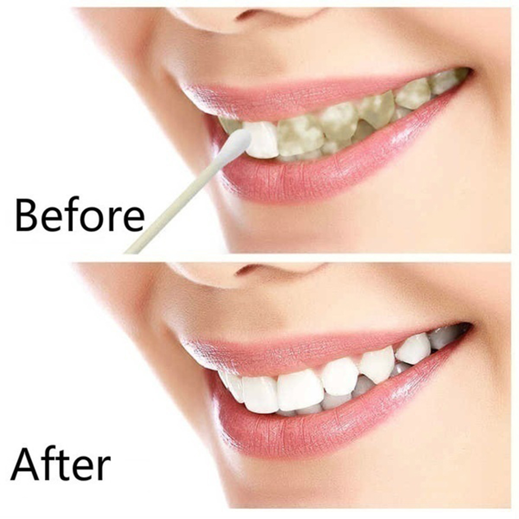 10ml Teeth Whitening Water Oral Hygiene Cleaning Teeth Care Tooth Cleaning Whitening Water Clareamento Dental Odontologia
