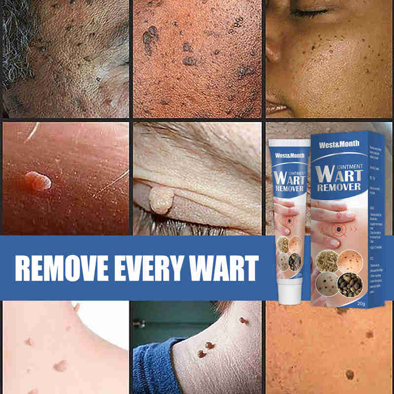 Skin Tag Remover Cream Painless Mole Skin Dark Spot Warts Remover Serum Freckle Face Wart Tag Treatment Removal Essential OIL