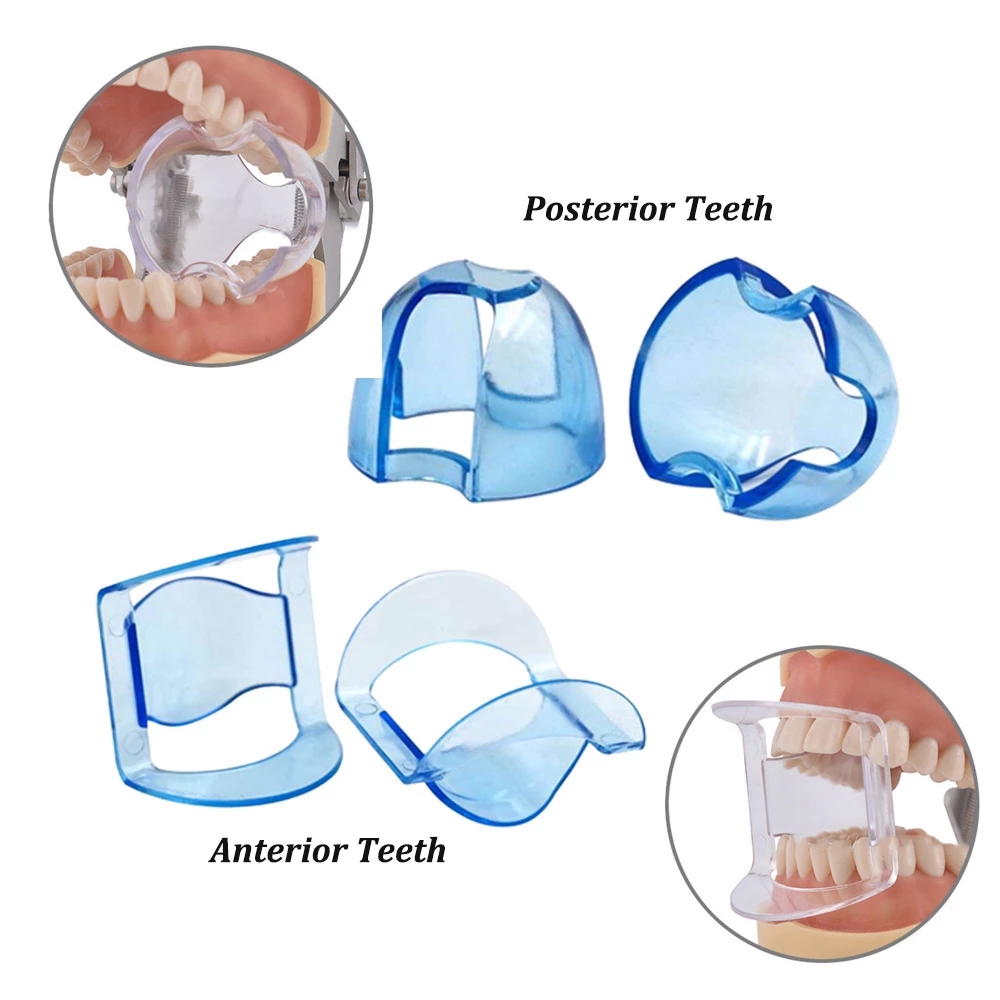 Dental Intraoral Cheek Retractor Lip Opener Teeth Whitening Front Teeth Back Teeth