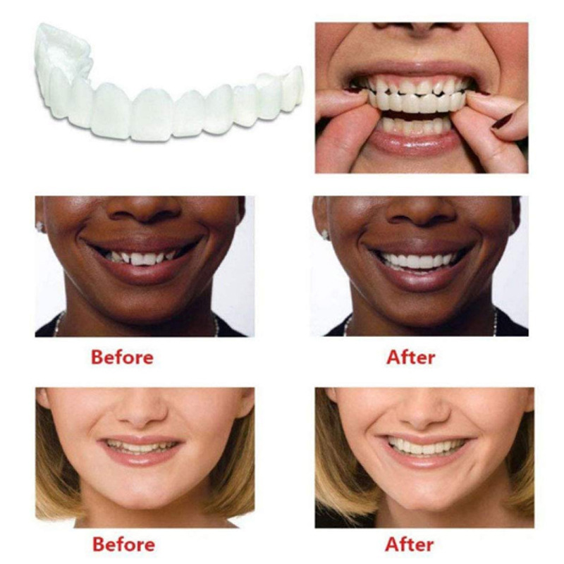 2-Piece Silicone Whitening Teeth Covers – Realistic Upper & Lower Dental Simulation Set