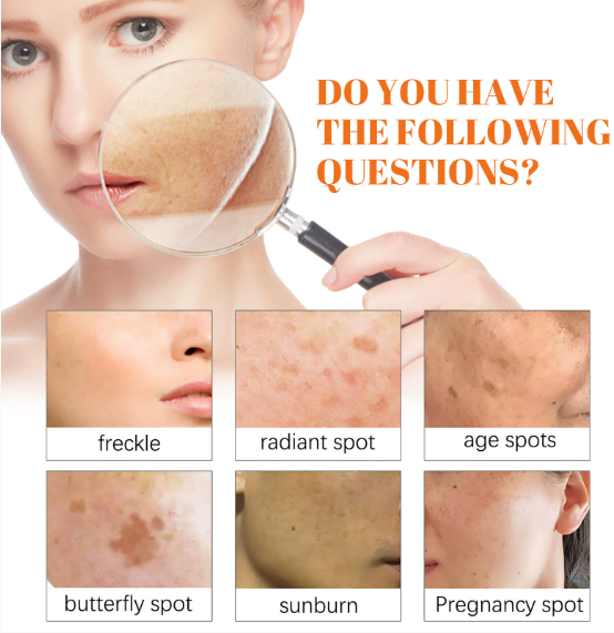 Freckle Whitening Face Cream Papaya Day Night Sun Spots Corrector Fade Pigment Brighten Skin Tone Blemish Bleaching Nourishing