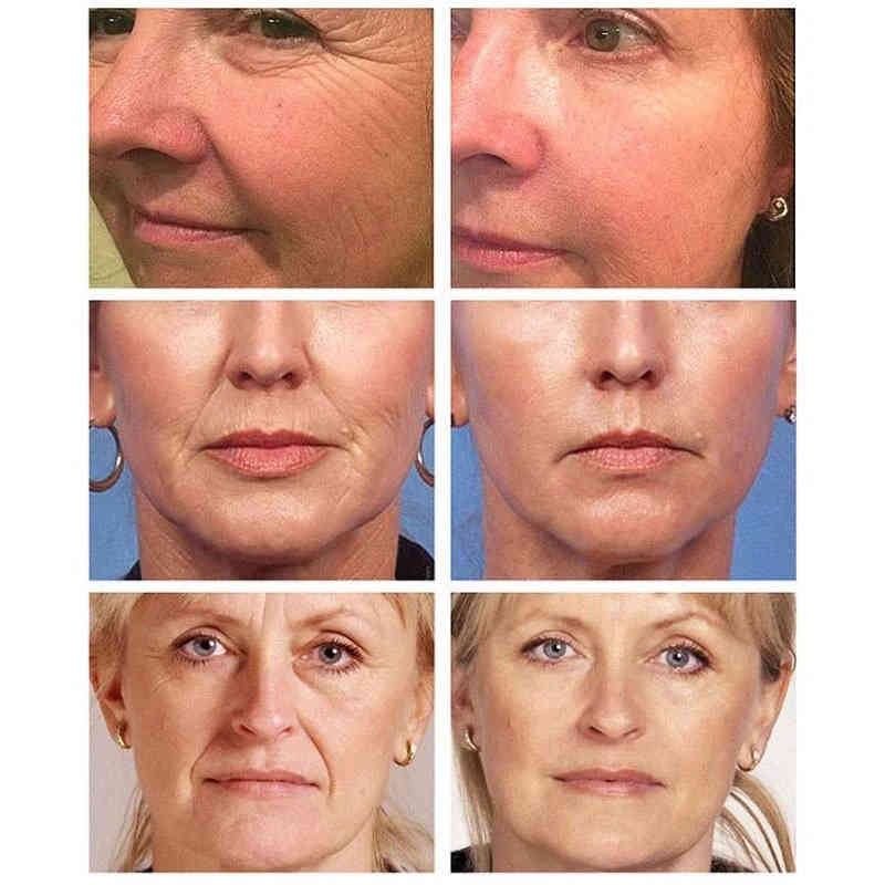 Retinol Moisturizer Day and Night Facial Retinol Cream Anti-Winkle Whitening Brightening Moisturizing Facial Skin Care